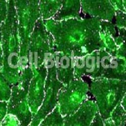 Human Epithelial Cells (14)